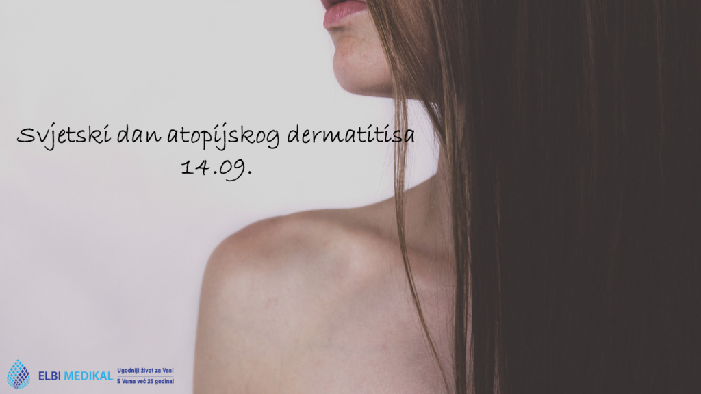 Svjetski dan atopijskog dermatitisa