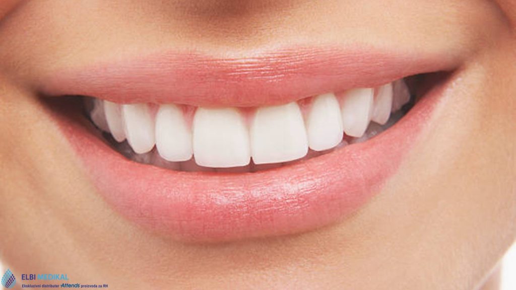 Najčešće bolesti zuba i usne šupljine